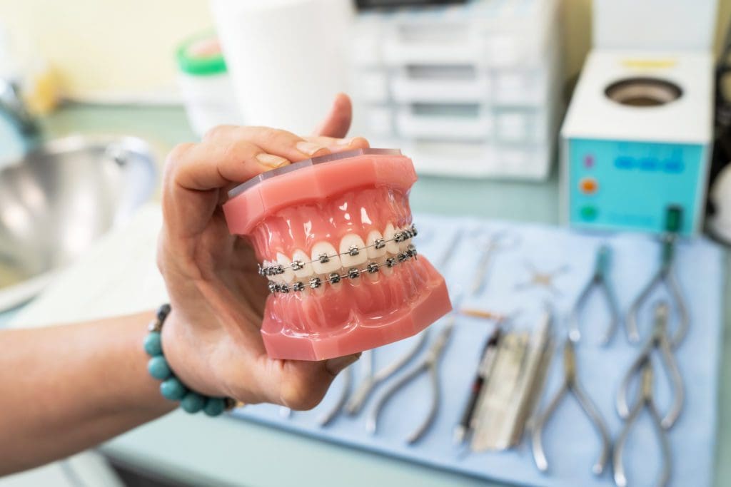 Оrthodontic model and dentist tool - demonstration teeth model of varieties of orthodontic bracket or brace